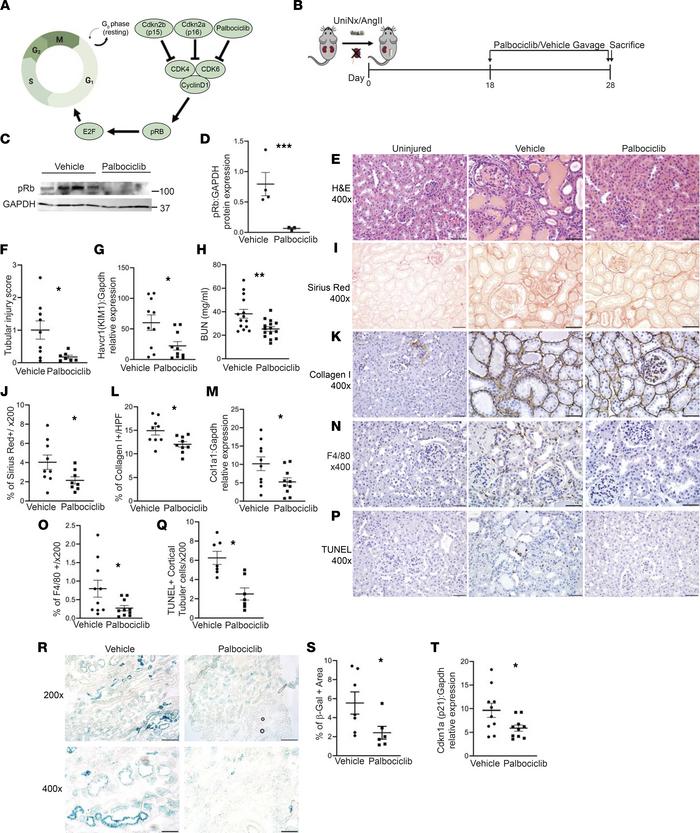 Blocking CDK4/6 reduces tubular injury, fibrosis, and senescence after U...
