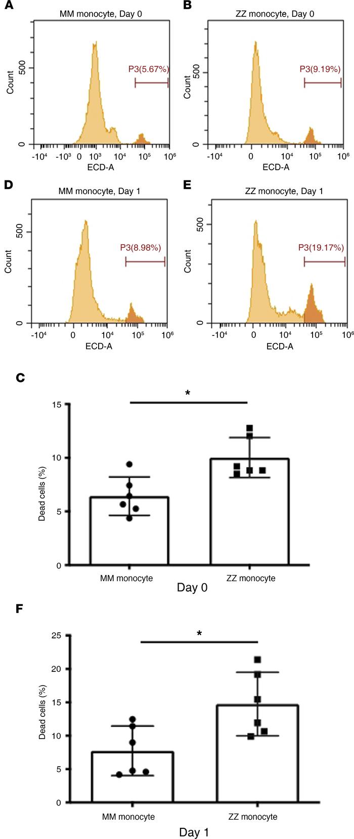 Accelerated death rate of monocytes homozygous for Z-AAT allele.
Monocyt...