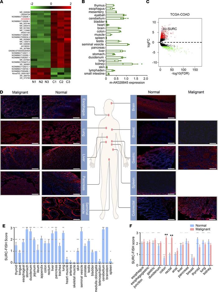 Identification of SURC as a specific upregulated lncRNA in CRC.
(A) Heat...