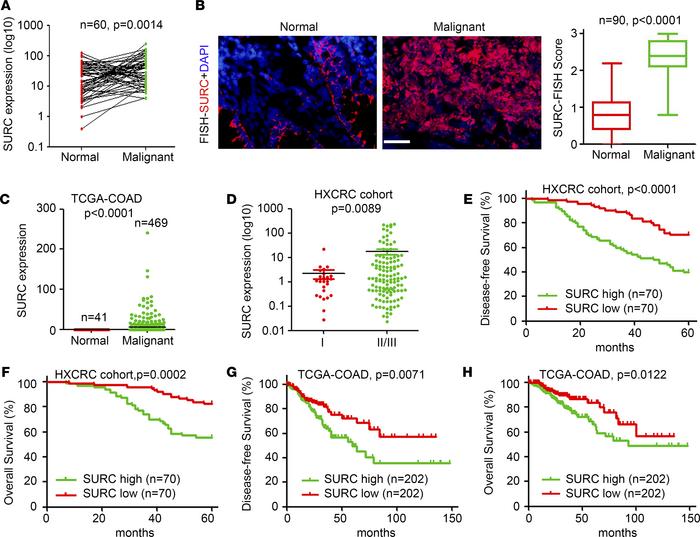 SURC upregulated in CRC and negatively correlated with prognosis.
(A) Up...