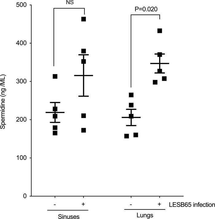 Spermidine is abundant in the murine respiratory tract, and bioavailabil...
