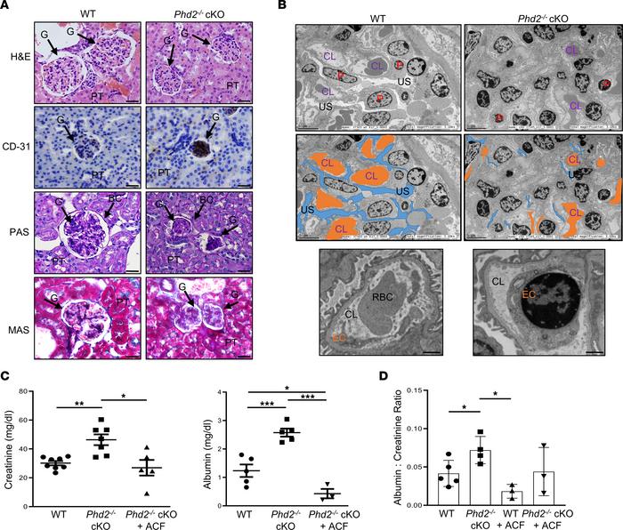 Removal of Phd2 in JZ layer leads to glomerular endotheliosis in the mot...