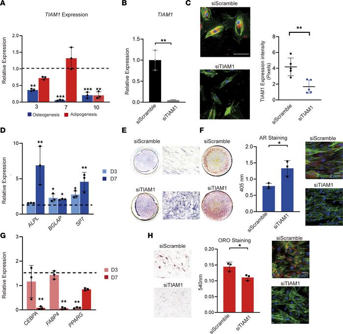 
TIAM1 knockdown favors osteogenic over adipogenic differentiation of hu...
