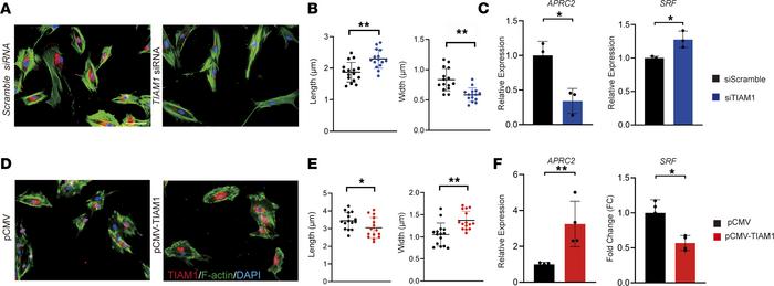 
TIAM1 misexpression alters pericyte cellular morphology and gene target...