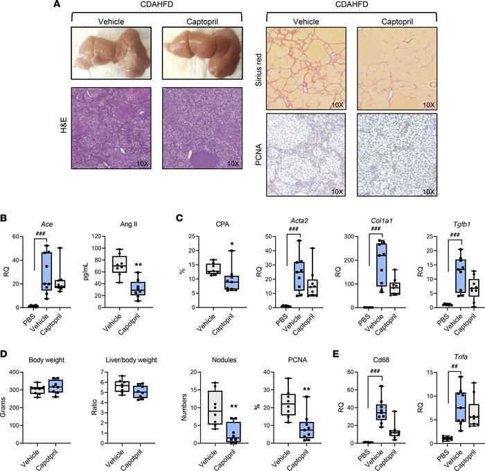 Captopril prevents liver fibrosis progression and cancer development in ...