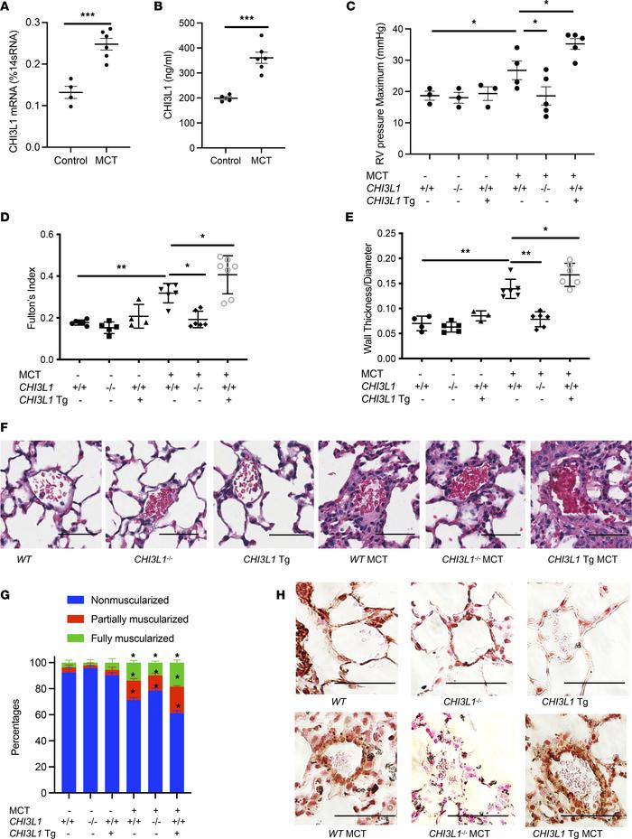 CHI3L1 plays a critical role in vascular remodeling responses in an MCT-...