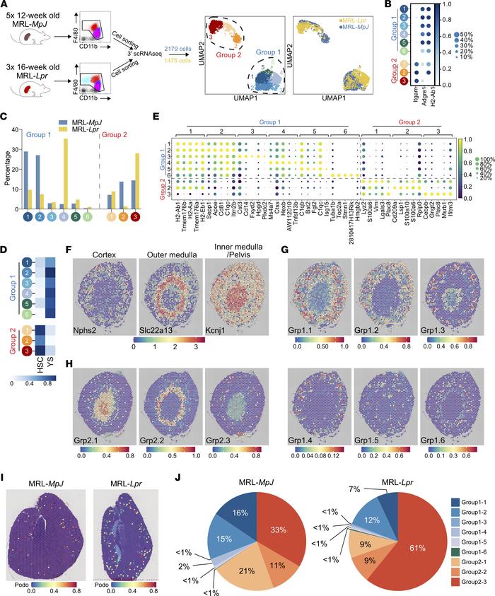 Lupus nephritis–associated macrophage heterogeneity at single-cell resol...