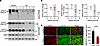 The expression of AMFR in the hippocampi of patients with TLE and KA-induce