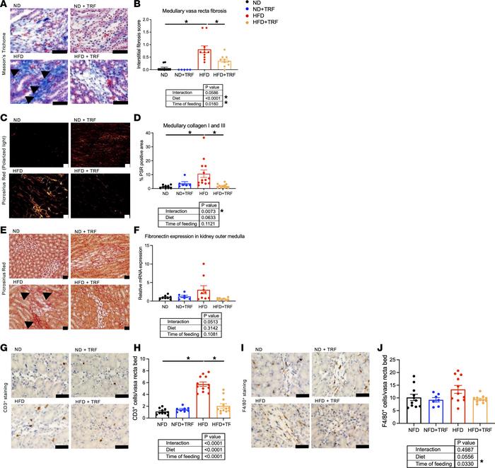 TRF reduces measures of kidney damage to the kidney medullary vasa recta...