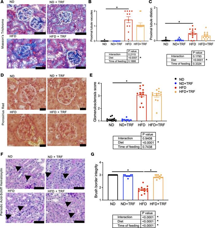 TRF reduces measures of kidney damage to glomeruli and cortical tubules ...