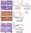 TRF reduces measures of kidney damage to glomeruli and cortical tubules in