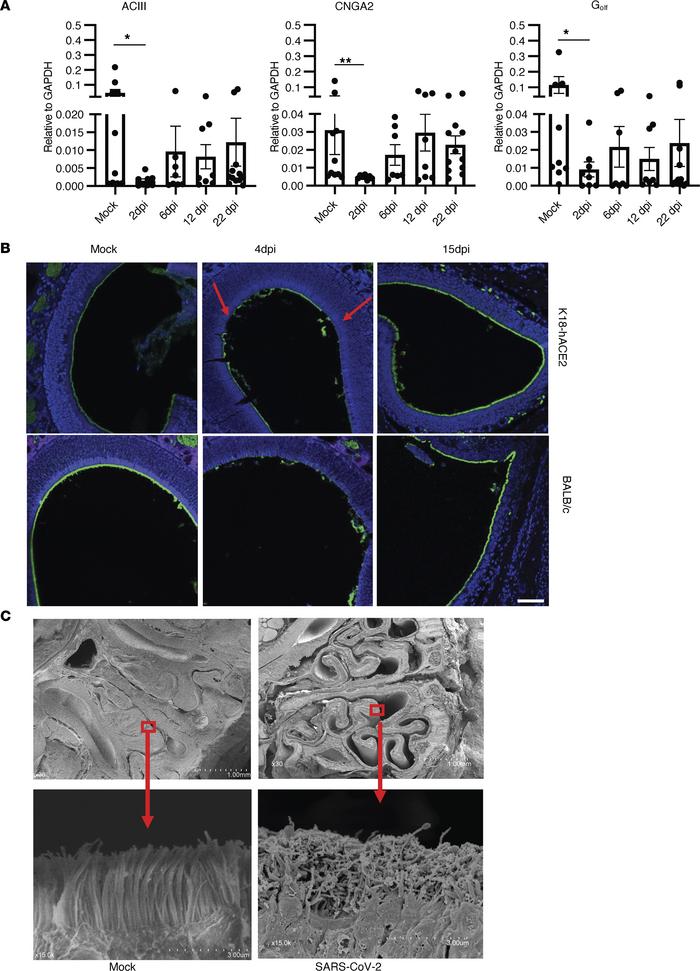 SARS-CoV-2 infection leads to altered signal transduction gene expressio...