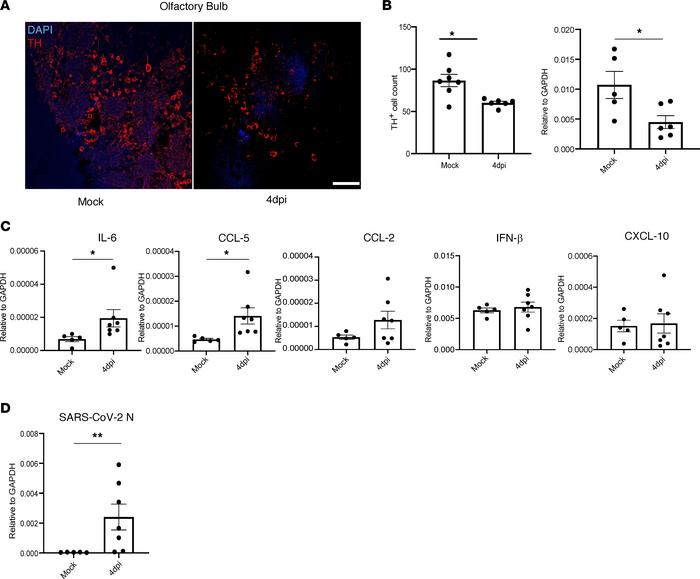 Fewer cells in the OB express tyrosine hydroxylase after SARS2-N501YMA30...
