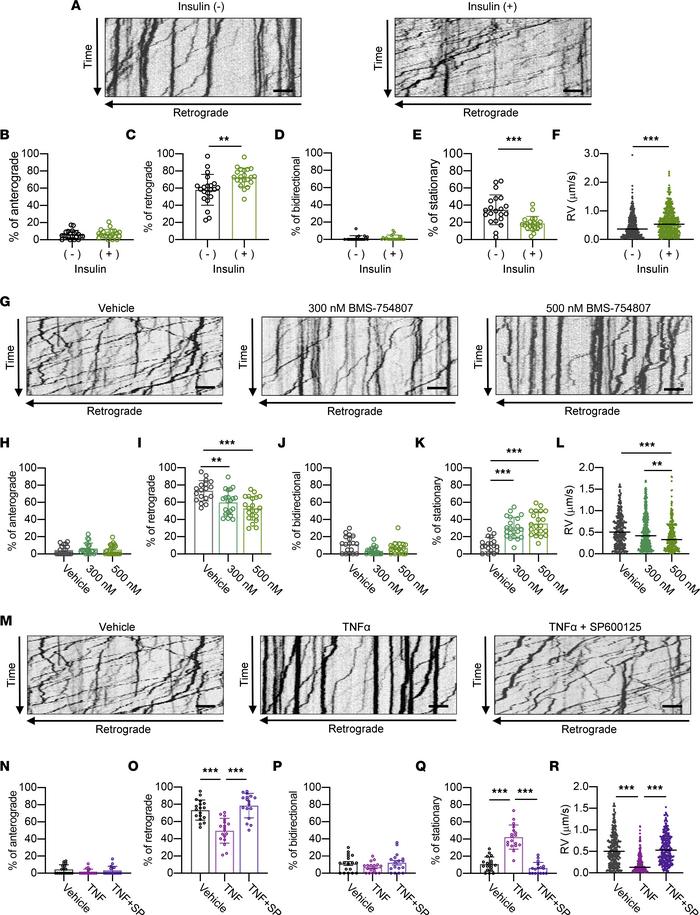 Disruption of insulin signaling impairs RAT in DRG neurons.
(A) Kymograp...