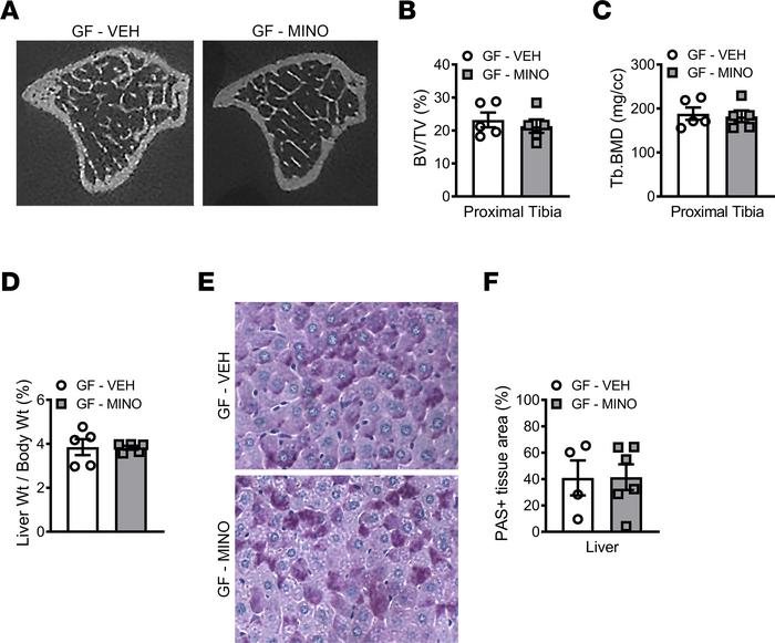 Minocycline effects on skeletal maturation and liver are microbiota depe...