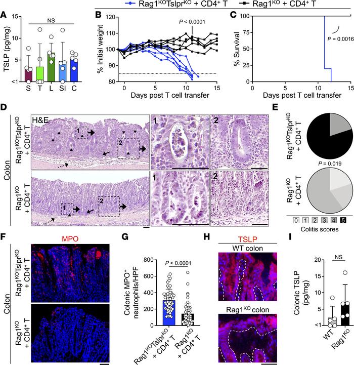 TSLP signaling is required to prevent acute, lethal colitis following ad...
