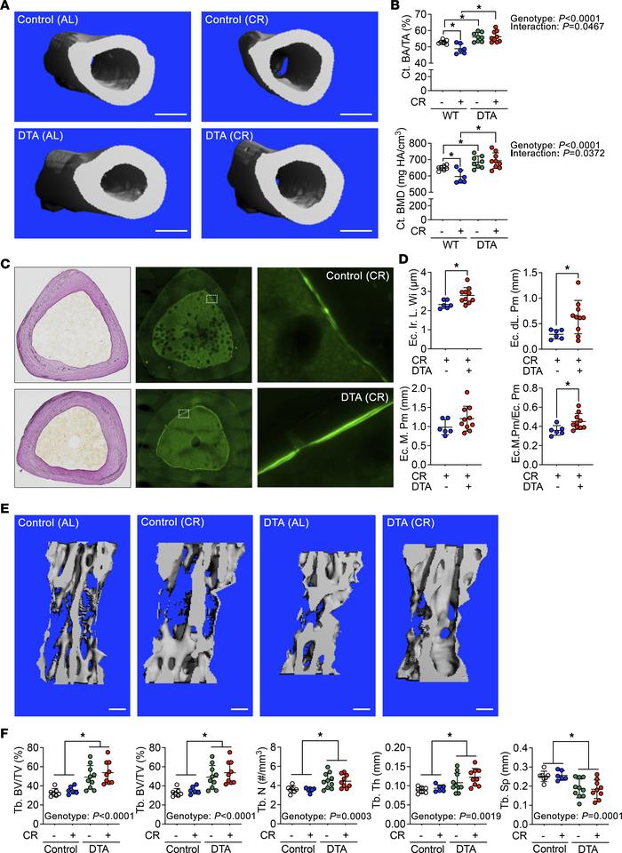 Loss of BMAds protects caloric restricted mice from loss of cortical bon...