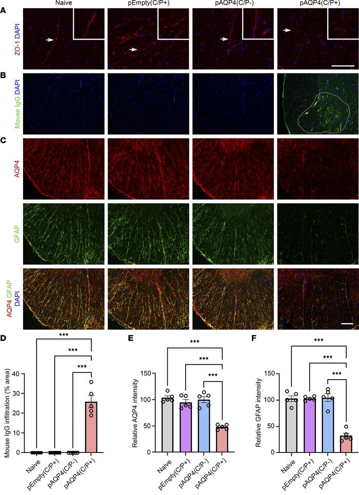 JCI Insight - T follicular helper cells contribute to pathophysiology ...