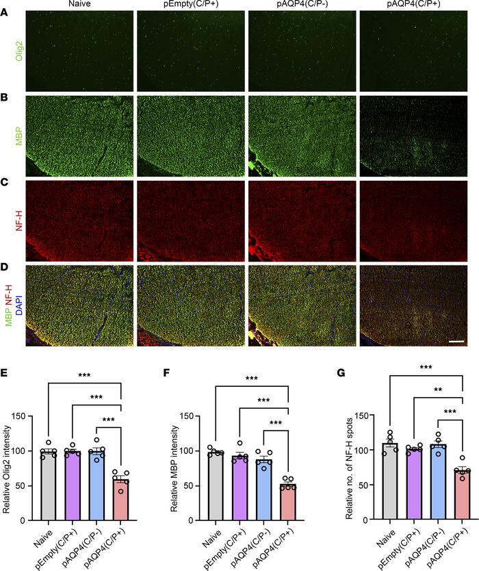 Oligodendrocyte loss, demyelination, and axonal loss after AQP4 immuniza...