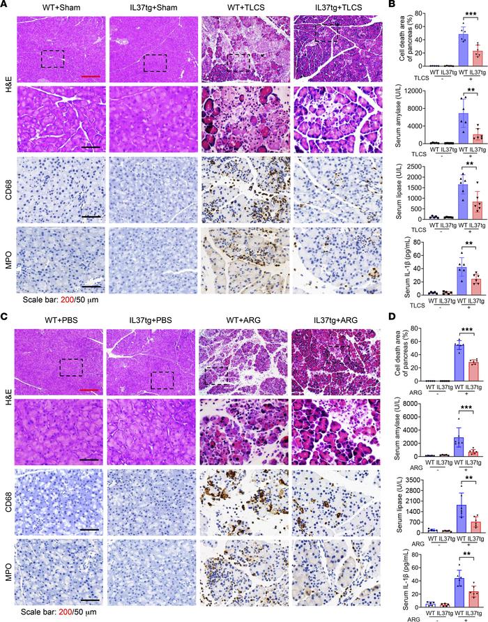 Protective effects of IL-37 in TLCS- and ARG-induced AP models.
(A and B...