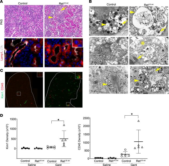 Neonatal RetUB del mice have more severe injury following gentamicin-ind...