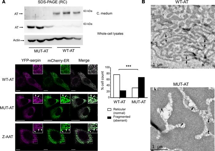 Morphological analysis of the intracellular consequences of recombinant ...