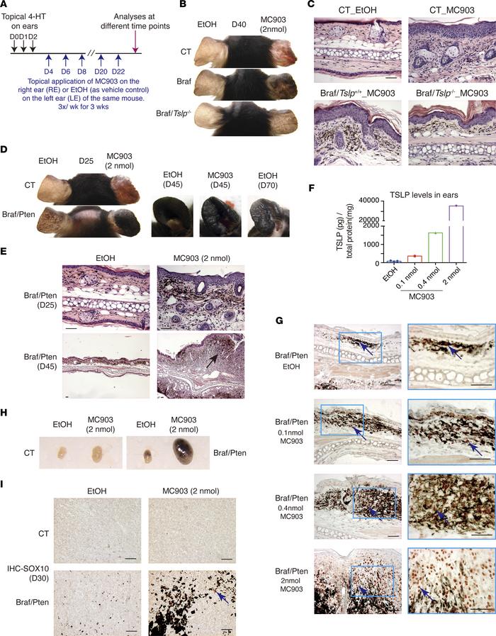 MC903-induced TSLP overexpression promotes and accelerates the growth an...