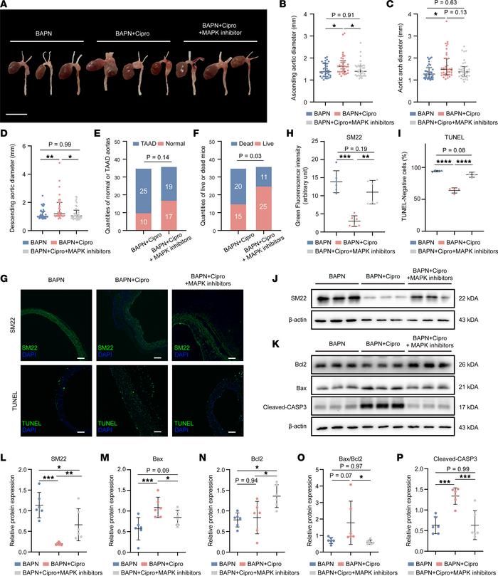 Ciprofloxacin-induced aggravation of thoracic aortic aneurysm in the mic...