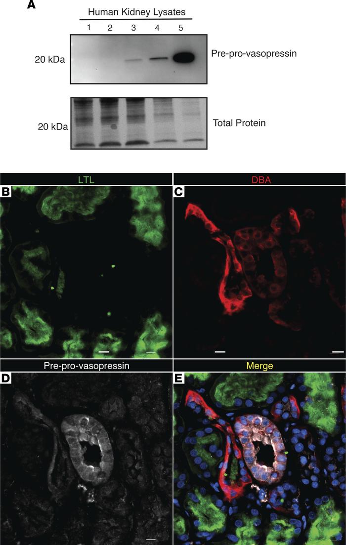 Human kidneys make vasopressin.
(A) Preprovasopressin was found in healt...
