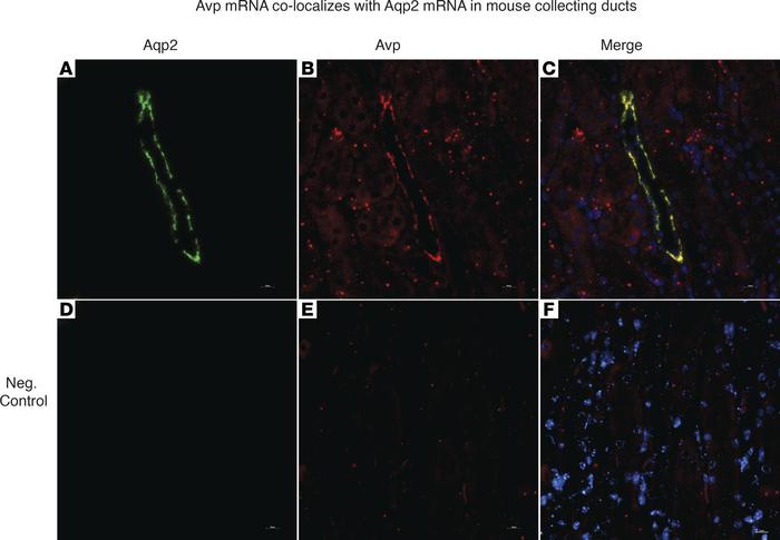 Vasopressin mRNA is found in mouse collecting duct cells in vivo.
RNA in...