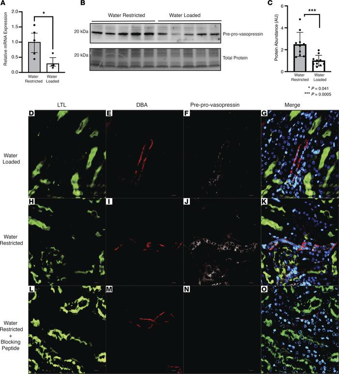 Kidney-derived vasopressin increases after water restriction.
(A) Avp mR...