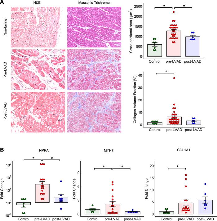 Impact of mechanical unloading on histopathology and gene expression of ...