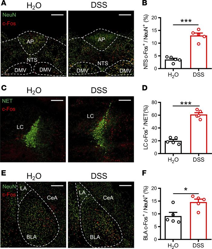 Profiling of c-Fos expression with multiple brain regions after the EPM ...