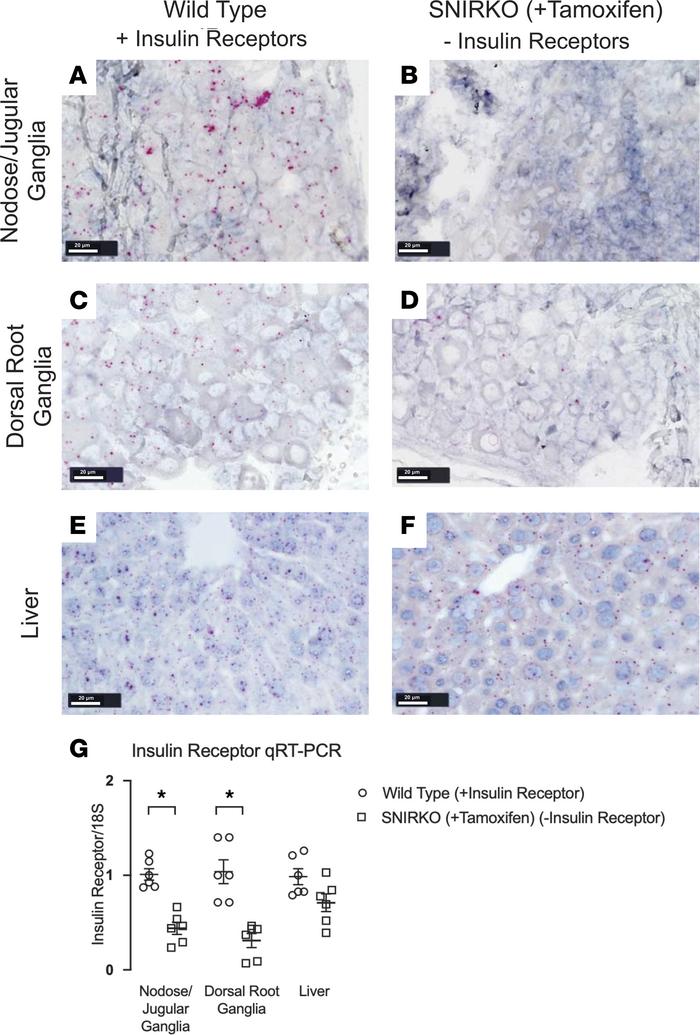 Creation and characterization of sensory neuron insulin receptor–KO (SNI...