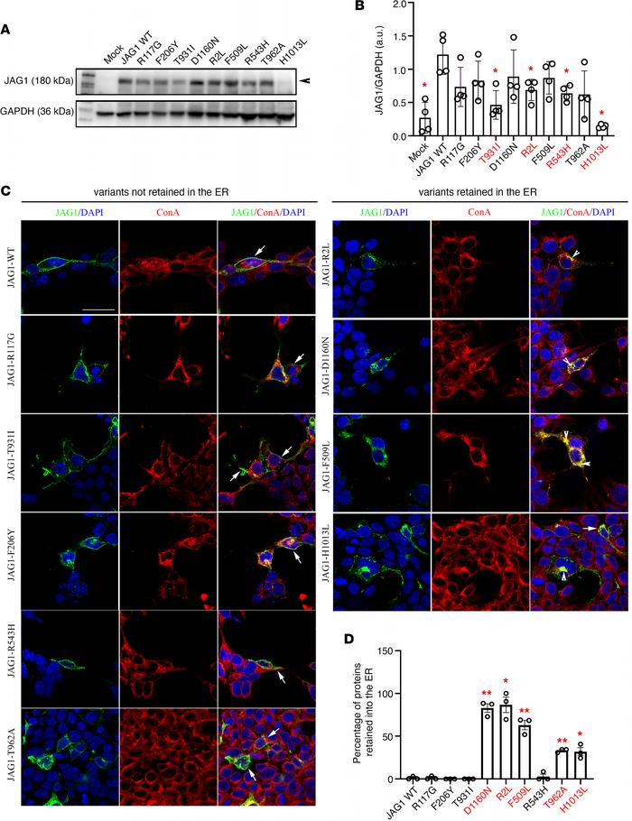 Functional validation of JAG1 variants in vitro.
(A) Representative West...