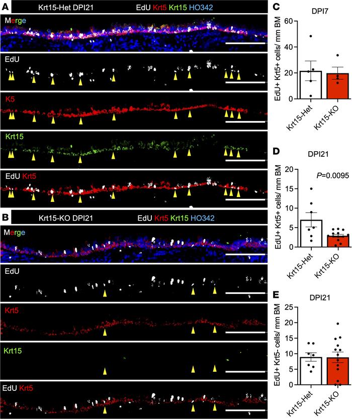 Krt15-KO leads to a decline in label-retaining BCs 21 days after injury....
