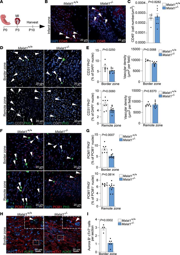 Malat1 deficiency impairs regenerative response and inhibits cardiomyocy...