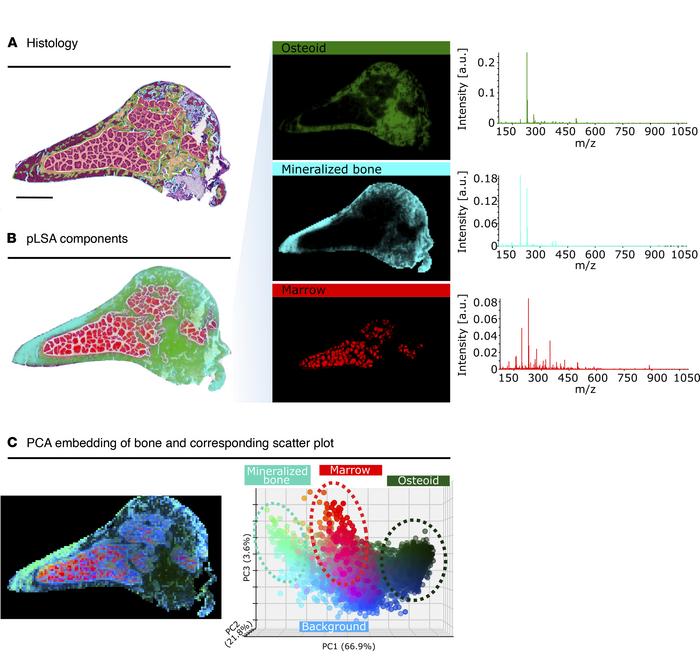 Histology of an undecalcified cryosection of a Hyp mouse femur and metab...