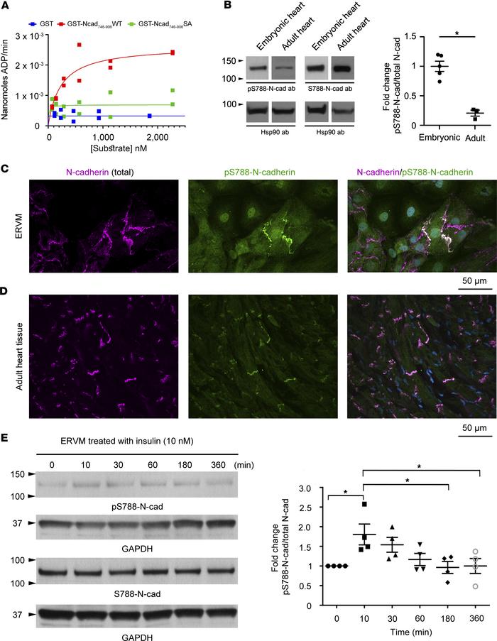 Obscurin-kin1 phosphorylates N-cadherin at Ser-788.
(A) Michaelis-Menten...