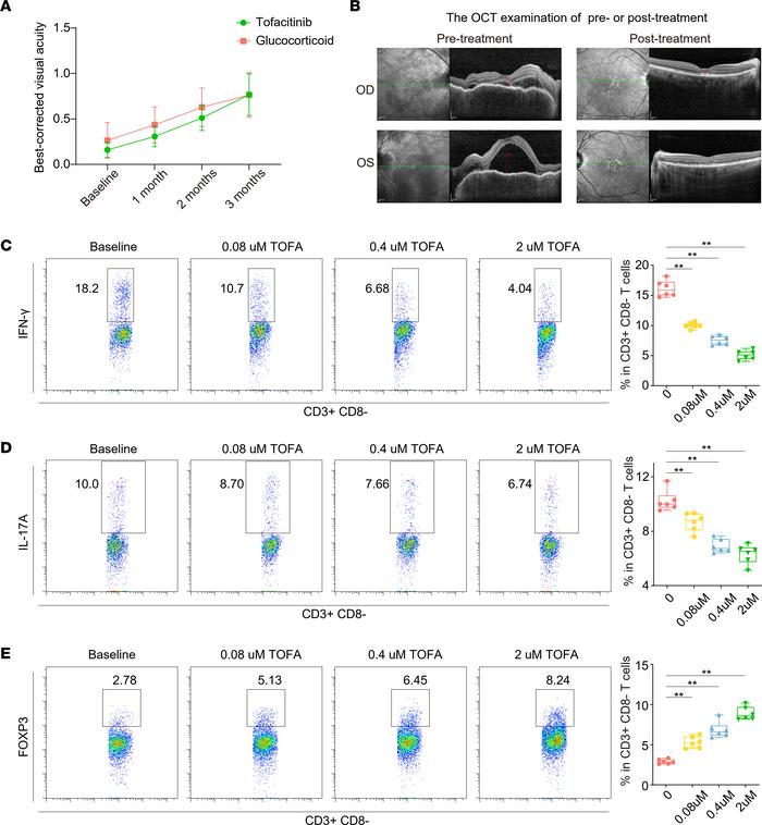 The therapeutic effect of TOFA treatment for VKH and the inhibitory effe...