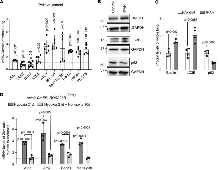 Autophagy-related genes are upregulated in lungs of IPAH humans and lung...