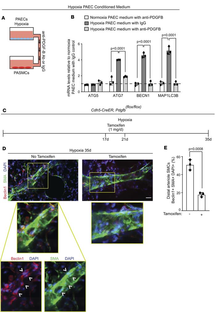 Pharmacological or genetic inhibition of EC-derived PDGF-B in mice or in...