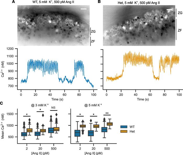 Calcium imaging in acute adrenal slices to determine the response of the...