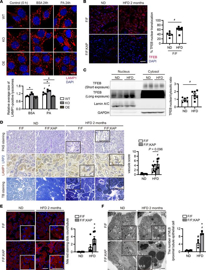 TFEB alleviates phospholipid accumulation in enlarged lysosomes during l...