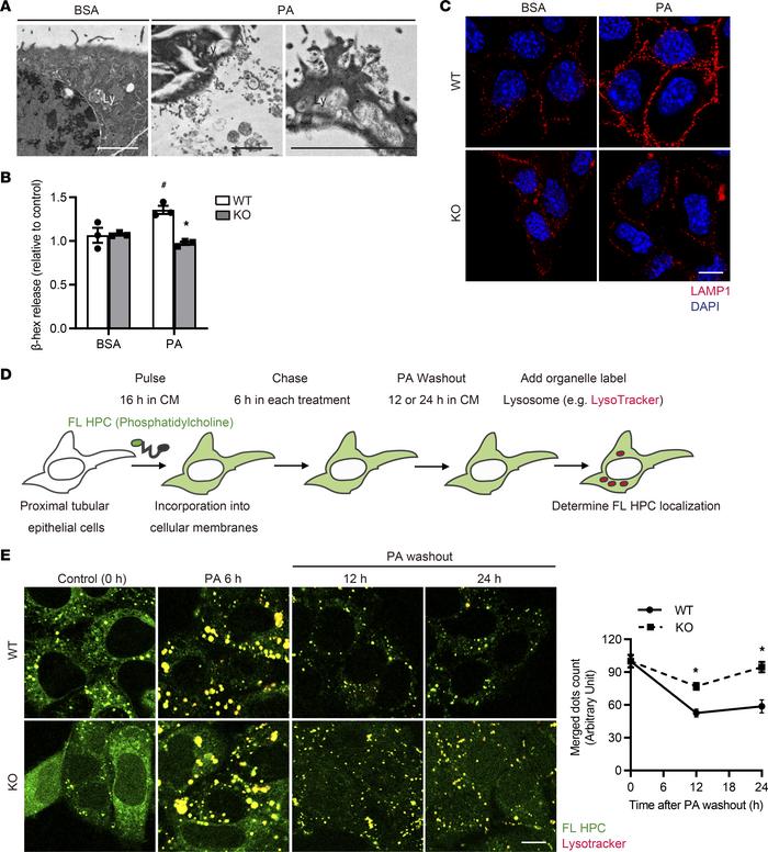 PA-induced TFEB activation promotes lysosomal exocytosis of phospholipid...