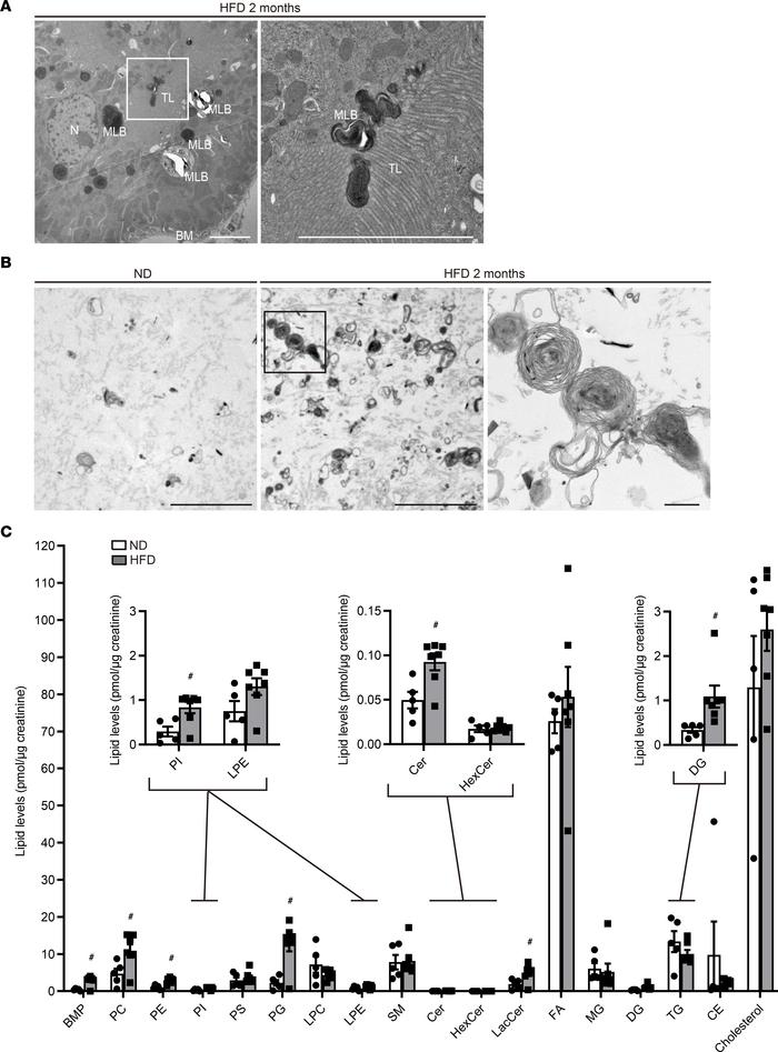 MLBs are released from the apical membrane of PTECs into the tubular lum...