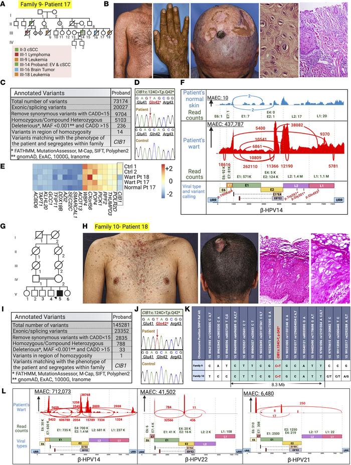 A homozygous nonsense CIB1 founder mutation shared across 2 unrelated fa...