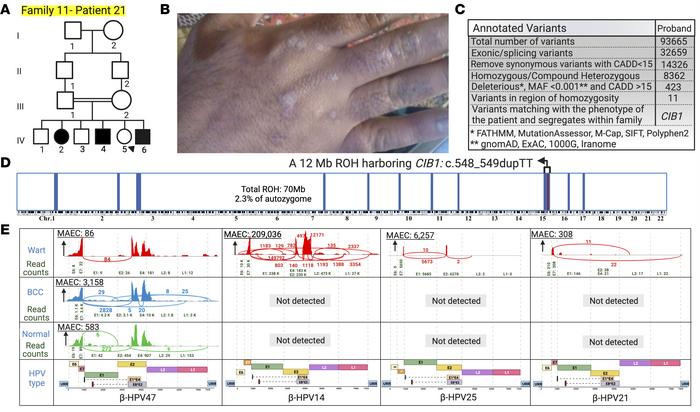 Family 11 pedigree, HM, genetic analysis, and skin virome profiling.
(A)...