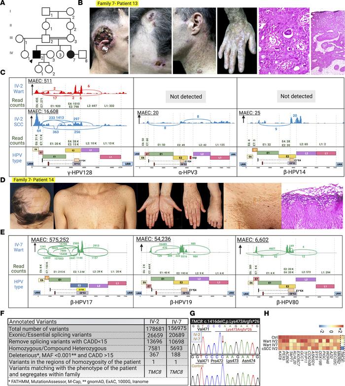 Family 7 pedigree, clinical manifestations, virome, and genetics, with t...