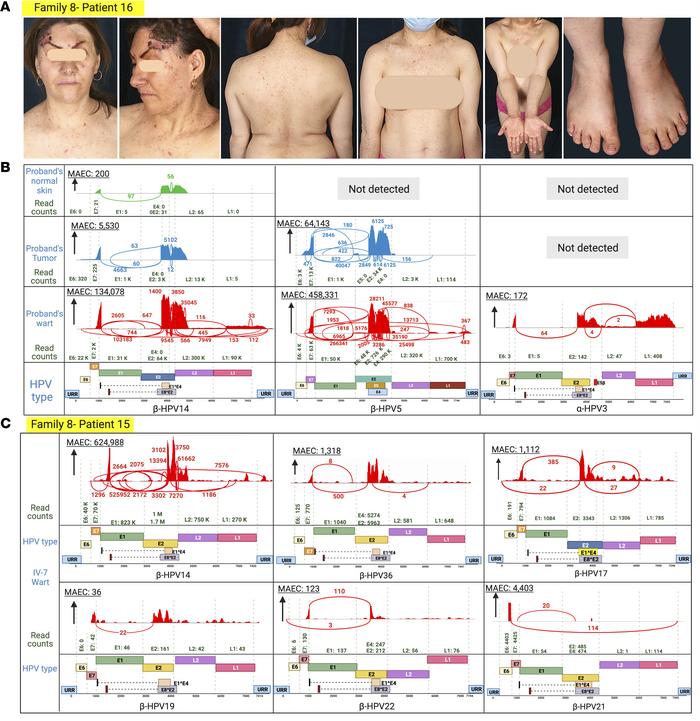 Family 8 clinical manifestations, and skin virome study.
(A) Same patien...